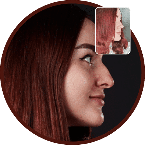 Nose Job Rhinoplasty in Turkey – All Included £2,750